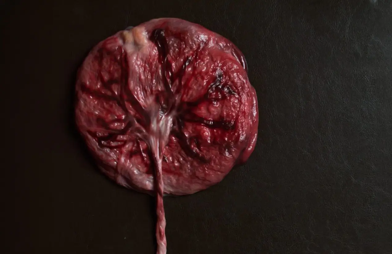 Jednu placentu prosím!