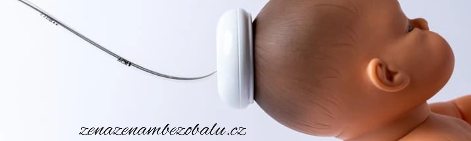 Co je to porod VEXEM?