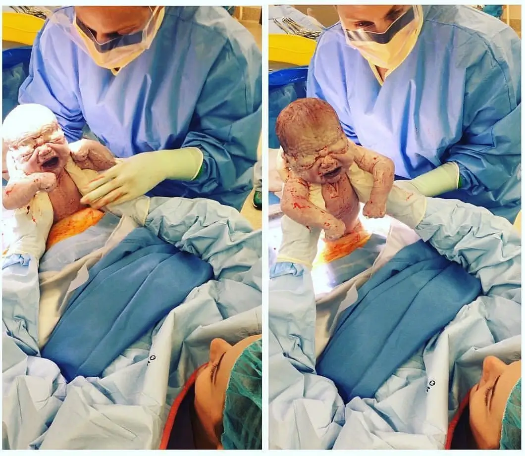 Jak se připravit na plánovaný císařský řez